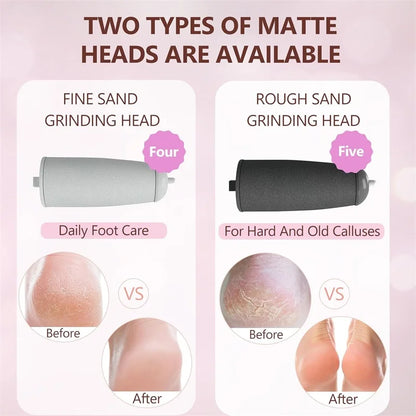 Comparison of two Rolli™ SmoothPro replacement roller heads – fine sand for daily foot care and rough sand for hard and old calluses, showing before and after results for smooth, healthy feet
